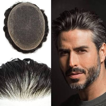 Hair Replacement Systems